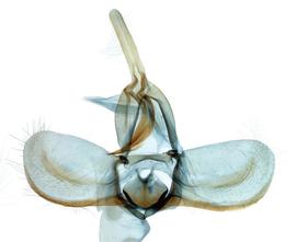  Male genitalia
