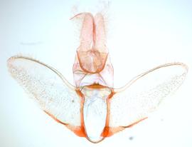  Male genitalia. © James Steffen. Image used with permission.
