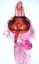  Female genitalia. © James Steffen. Image used with permission.
