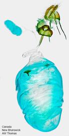  Female genitalia. © Dr. A. W. Thomas. Image used with permission.
