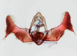  Male genitalia. © James Steffen. Image used with permission.
