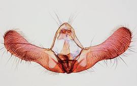  Male genitalia. © James Steffen. Image used with permission.
