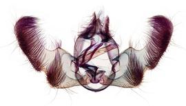  Male genitalia
