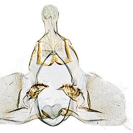  Male genitalia
