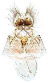  Female genitalia
