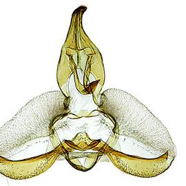  Male genitalia

