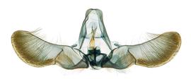  Male genitalia
