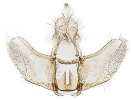  Male genitalia
