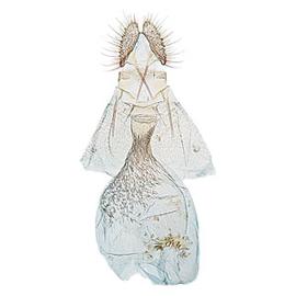  Female genitalia
