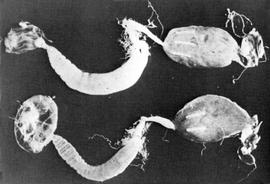   Nosema  infection of midgut (top), normal midgut (bottom); photo by USDA
