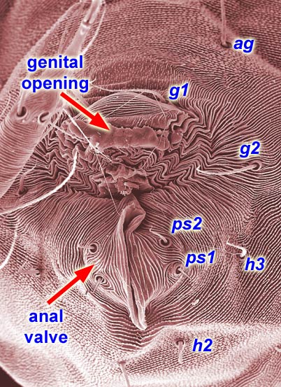 Tetranychinae - Genitalia.