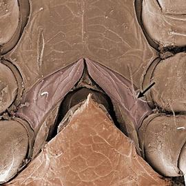 Parasitid genital-metasternal complex (DEW)