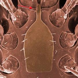Anterior median process