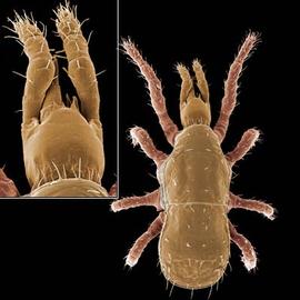 Gnathosoma with a sclerotized ring, the basis capitulum,  Gamasellodes  sp. (DEW)