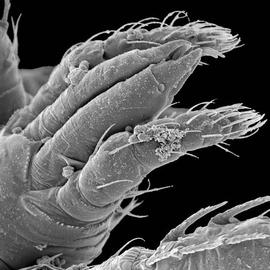   Ameroseius  chelicerae (DEW)
