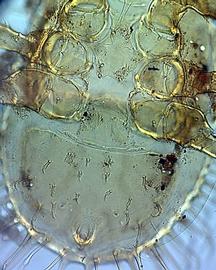  Gamasellus  ventral shields with soil layer removed (DEW)