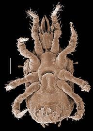  Ectoantennoseius  female venter