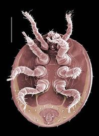   Evimirus   uropodinus  venter (DEW)
