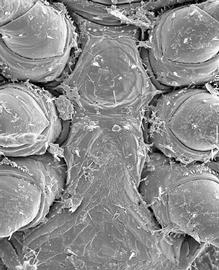  Heatherella  sterno-genital area of female (DEW)