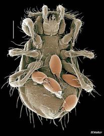 Five hypopi attached to venter of ologamasid mite (DEW)
