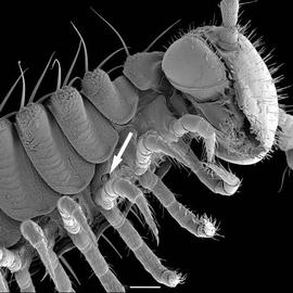 Tracheal openings of a millipede (DEW)