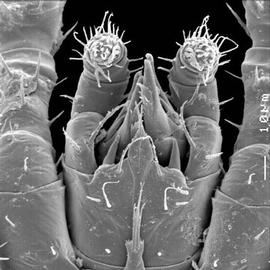  Chelicerae;  Microgynium  subcapitulum (Oregon) (DEW)