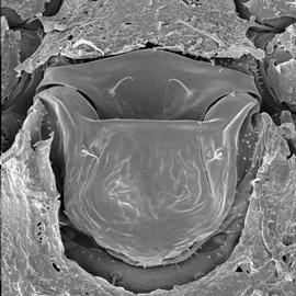 Nothogynus  genital-sternal complex (DEW)