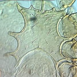 Ologamasid sternal shield (DEW)