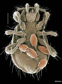  Ologamasid bearing acarid hypopi (DEW)

