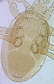  Zygoseius  female venter