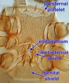  Female sternal-genital region
