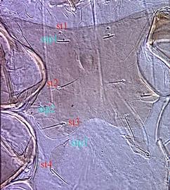  Platyseius  sternal region