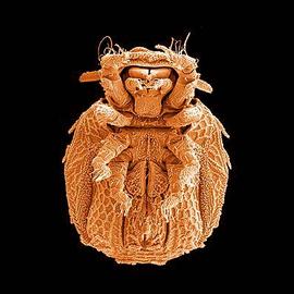  Sphaerochthonius  venter (DEW)