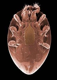 Female uropodid (DEW)