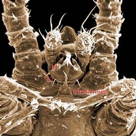  Larval uropodid (DEW)
