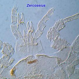  Zercoseius  female chelicerae