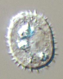  urediniospore of  U. monsterae 
