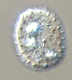  urediniospore of  U. monsterae 
