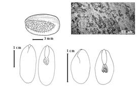  Seed, cotyledon, embryo, and testa:  A. acle  (Blanco) Merrill - bottom left cotyledons concealing all but tip of radicle (L) and embryonic axis (R);  A. lebbeck  (C. Linnaeus) G. Bentham - testa SEM;  A. leptophylla  H.A.T. Harms - top left seed topography;  A. niopoides  (G. Bentham) A.E. Burkart - bottom right cotyledons concealing all of the radicle (L) and embryonic axis (R).
