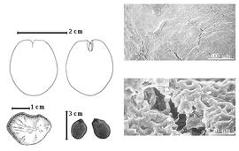  Seed, cotyledon, embryo, and testa:  A. nobilis  N. Wallich - top left cotyledon notched and split and concealing radicle (L) and embryonic axis (R), bottom far left seed topography, bottom left center seeds, testa SEMs.
