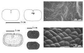  Seed, cotyledon, embryo, and testa:  A. streptocarpa  (Fournier) I.C. Nielsen - top left cotyledon not concealing radicle (L) and embryonic axis (R), bottom left seed topography, bottom left center seeds, testa SEMs.
