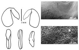  Cotyledon, embryo, and testa:  A. crassicarpus  T. Nuttall - embryo, cotyledons, and testa SEMs.
