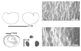  Seed, cotyledon, embryo, and testa:  B. riedelii  (E.L.R. Tulasne) J.H. Kirkbride - top left cotyledon split and concealing radicle (L) and embryonic axis (R), bottom far left seed topography, bottom left center seeds, testa SEMs.
