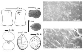  Seed, cotyledon, embryo, and testa:  B. coriacea  Keay - bottom center seed topography;  B. grandiflora  (M.H. Vahl) Hutchinson & Dalziel - bottom left center seed topography, center seed;  B.  spp. - top far left and bottom far left cotyledons split and concealing radicle (above or left) and embryonic axes (below or right), top left center seed, testa SEMs.
