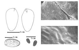  Seed, cotyledon, embryo, and testa:  B. filicifolia  Baillon - top left cotyledon entire and concealing radicle (L) and embryonic axis (R), bottom far left seed topography, bottom left center seeds, testa SEMs.
