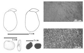  Seed, cotyledon, embryo, and testa:  B. insignis  J.-H. Humbert - top left cotyledon entire and not concealing radicle (L) and plumule rudimentary (R), bottom far left seed topography face view (L) and hilar view (R), bottom left center seeds, testa SEMs.
