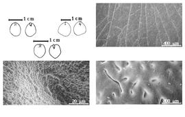  Cotyledon, embryo, and testa:  C. bonduc  (C. Linnaeus) W. Roxburgh - top left center cotyledon split and basally groined and concealing all but tip of radicle (L) and embryonic axis (R);  C. gilliesii  Wallroth - testa SEMs, top far left cotyledons notched and investing exposed radicle (L) and embryonic axis (R);  C. sepiaria  W. Roxburgh - left center cotyledons notched and investing exposed radicle (L) and embryonic axis (R).
