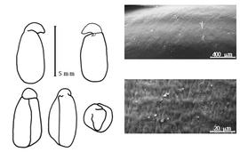  Cotyledon, embryo, and testa:  C. densa  V.L. Komarov - embryo, cotyledons, and testa SEMs.
