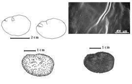  Seed, cotyledon, embryo, and testa:  C. catenaeformis  W.A. Ducke - top left cotyledons concealing all but radicle tip (L) and embryonic axis (R), bottom left seed topography, bottom right seed, testa SEM.
