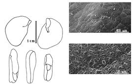  Cotyledon, embryo, and testa:  C. paraense  E.L.R. Tulasne - embryo, cotyledons, and testa SEMs.
